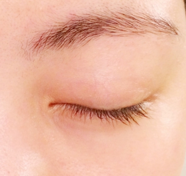 目の周りの白いポツポツ 子供や女性に多い稗粒腫とは ライフスタイルシード